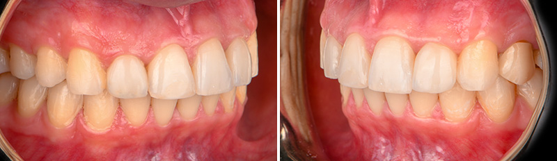 Restauration postérieure, côté ferme