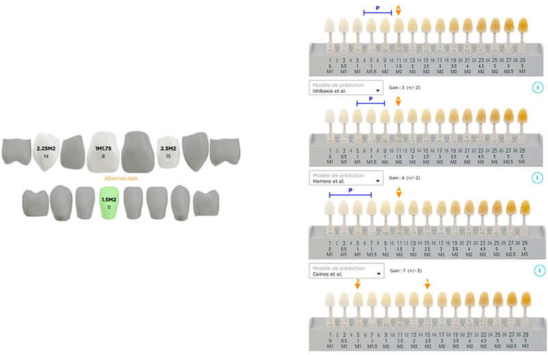 Résultats dent par dent et comparaison aux prédictions