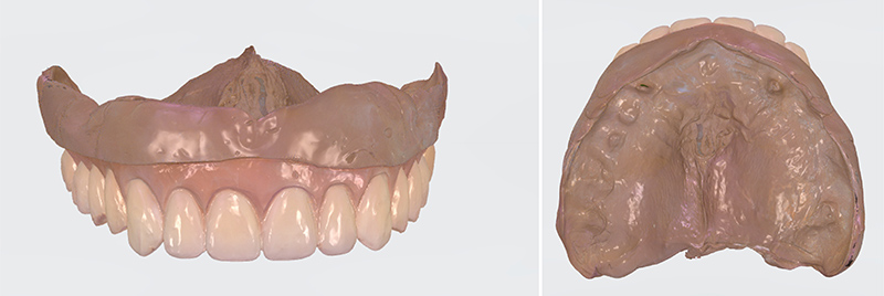 numérisation d’empreintes physico-chimiques ou de prothèses existantes 